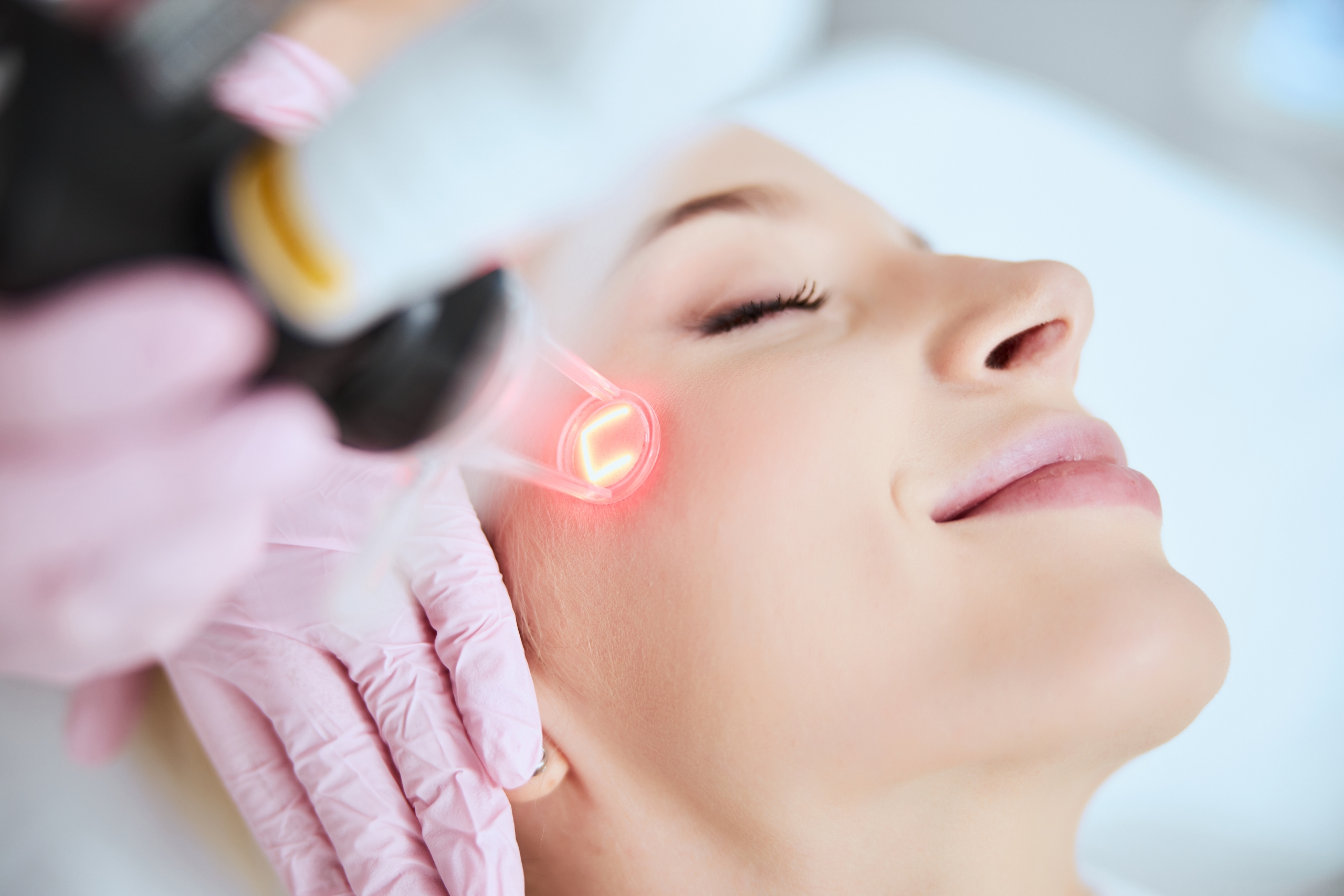 Laseroterapia – co trzeba wiedzieć o zabiegach laserowych